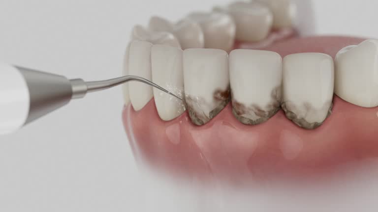 Reliable Wisdom Tooth Removal contractor in Medina County County, OH by Dentist Open Now